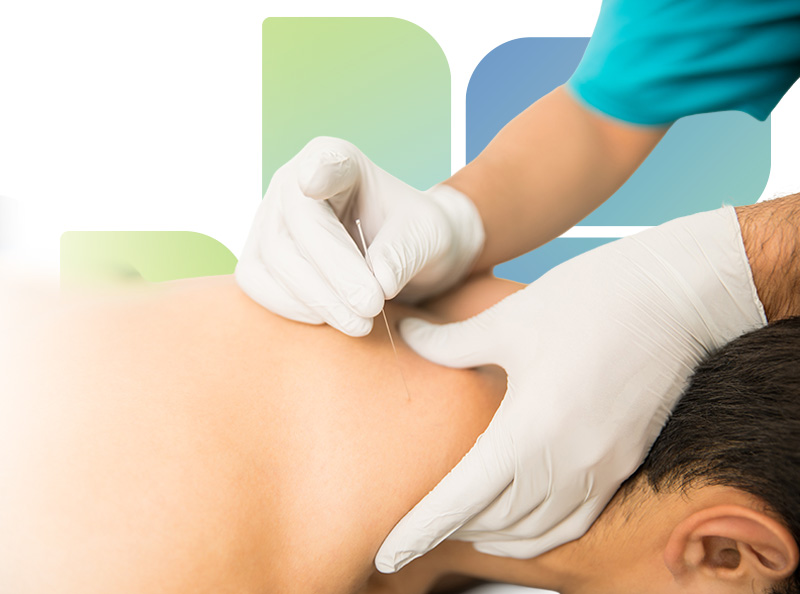 Physical therapist performs dry needling on a patient